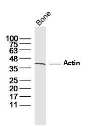 Anti-ACTA1 Polyclonal Antibody