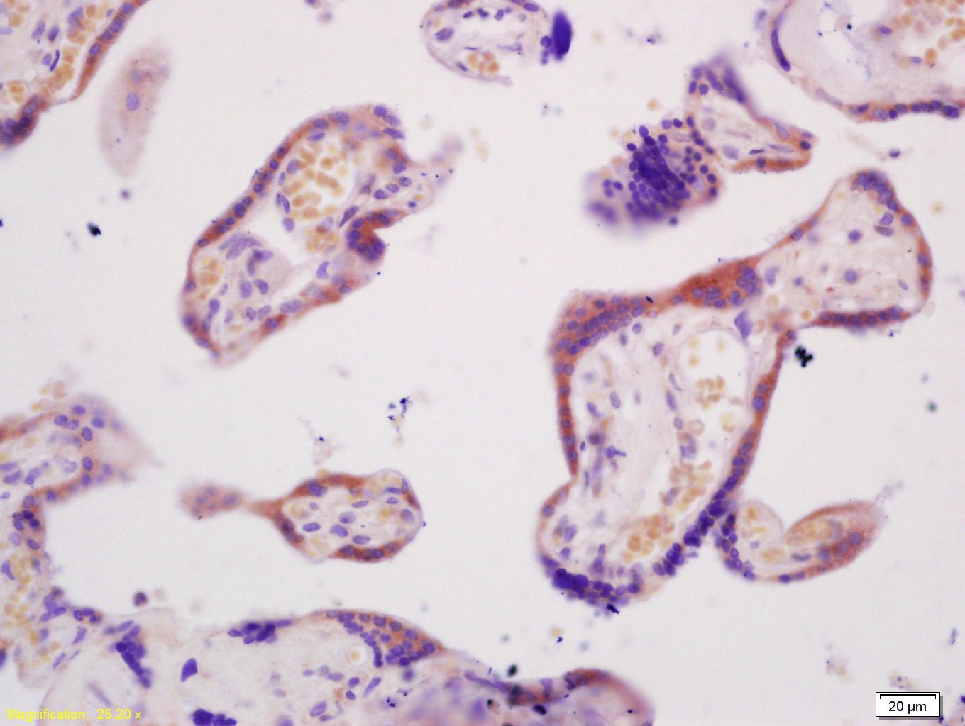 Anti-ABCG2 Polyclonal Antibody