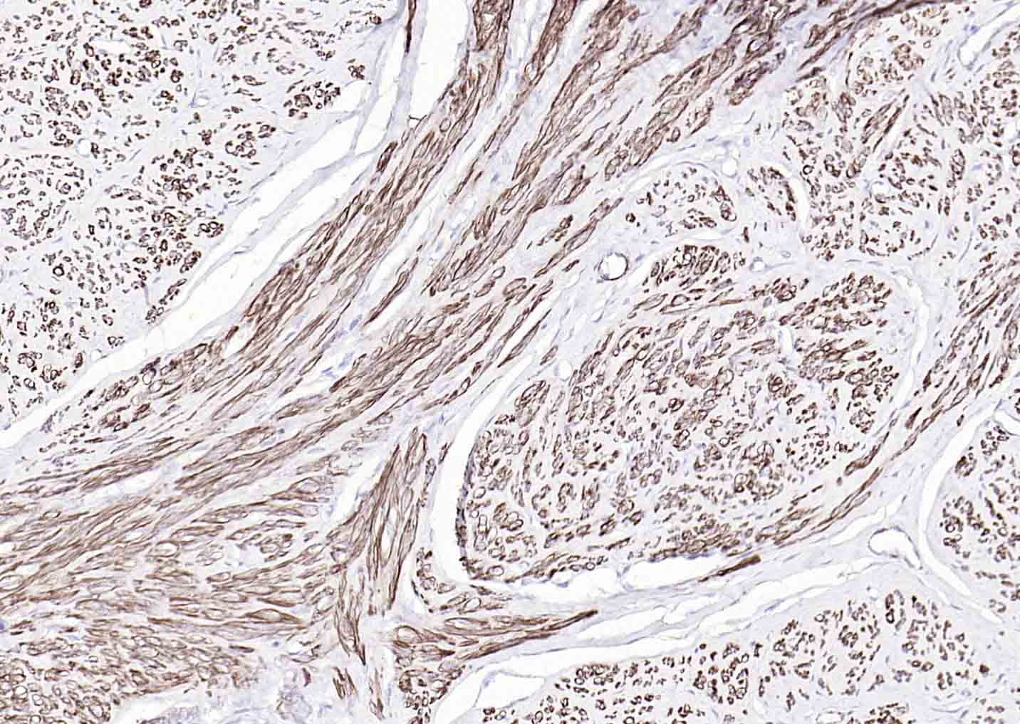 Anti-ACTA2 Antibody (7C949)