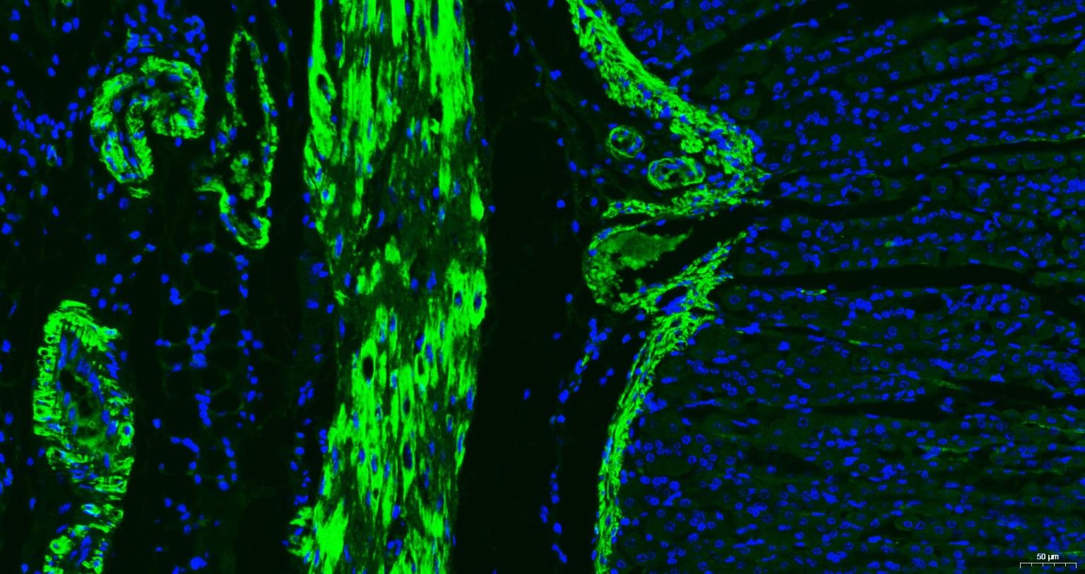 Anti-ACTA2 Antibody (6K554)