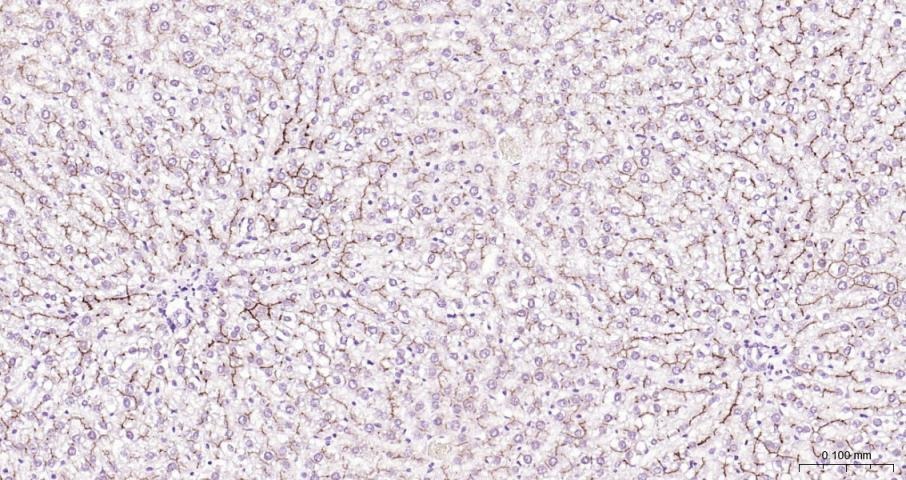 Anti-ABCB1 Polyclonal Antibody