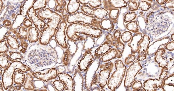 Anti-ACSL4 Antibody (6H118)