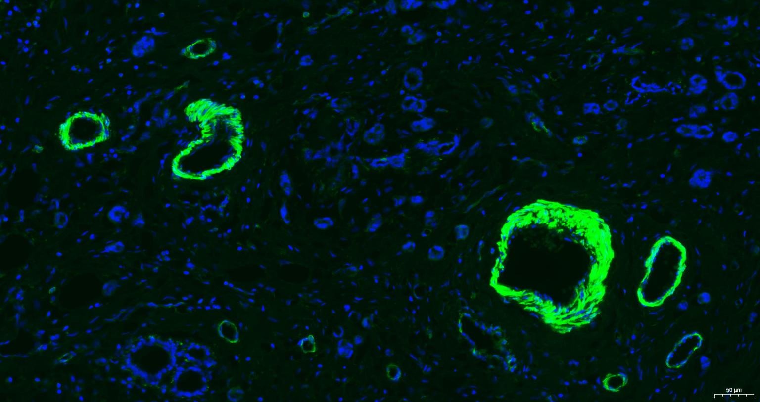 Anti-ACTA2 Antibody (6K554)