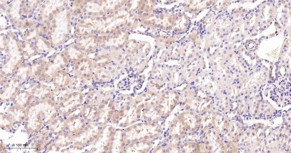 Anti-ACSL4 Antibody (6H118)