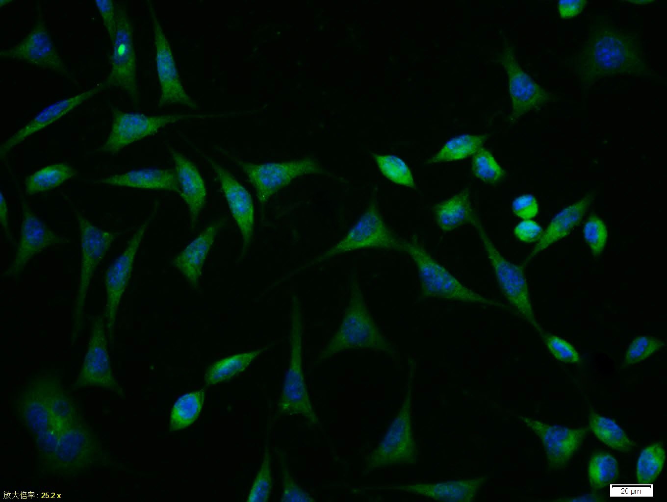 Anti-ABCB1 Polyclonal Antibody 2