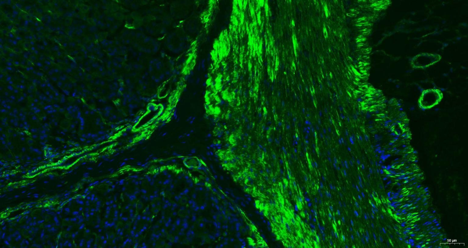 Anti-ACTA2 Antibody (6K554)