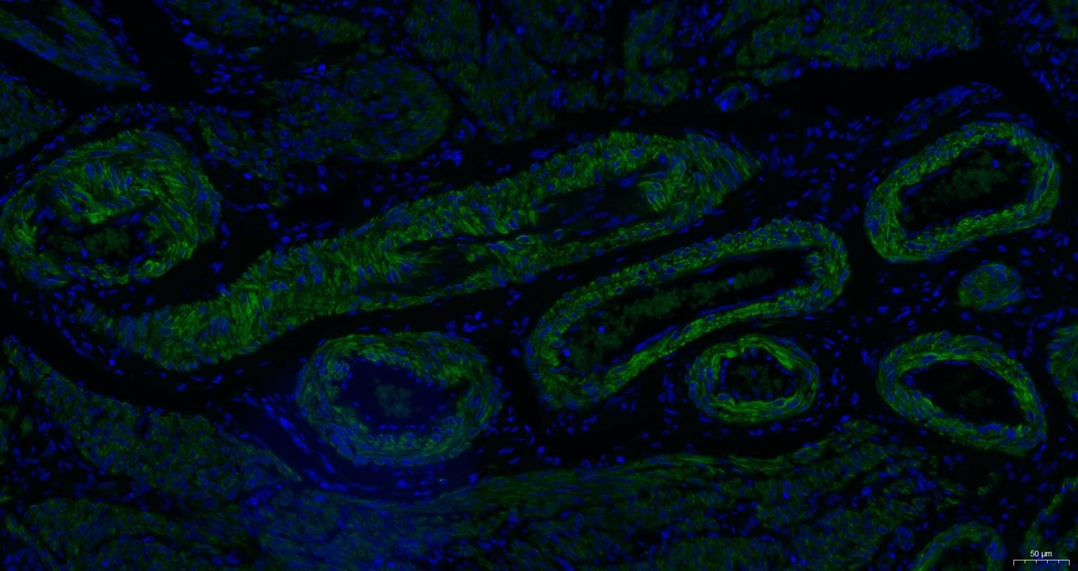 Anti-ACTA2 Antibody (7C949)