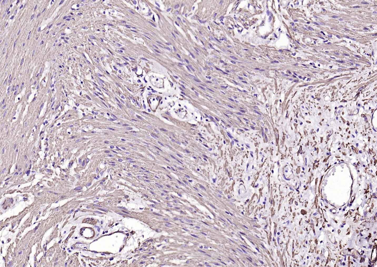 Anti-ACTA2 Antibody (7C949)