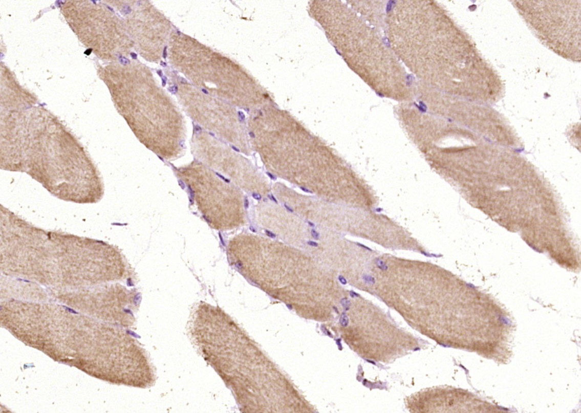 Anti-ACTA1 Polyclonal Antibody