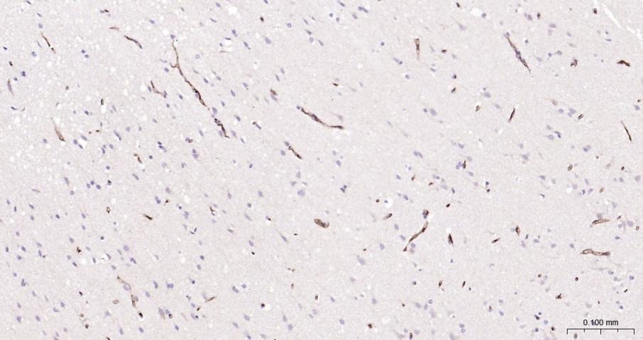 Anti-ABCB1 Polyclonal Antibody