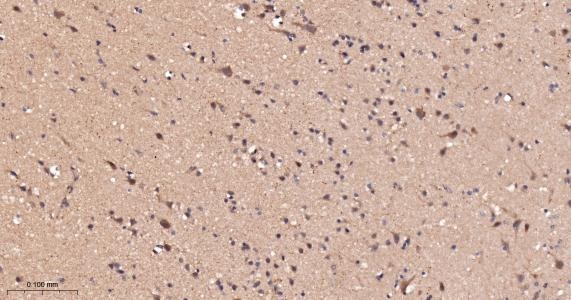 Anti-ACSL4 Antibody (6H118)