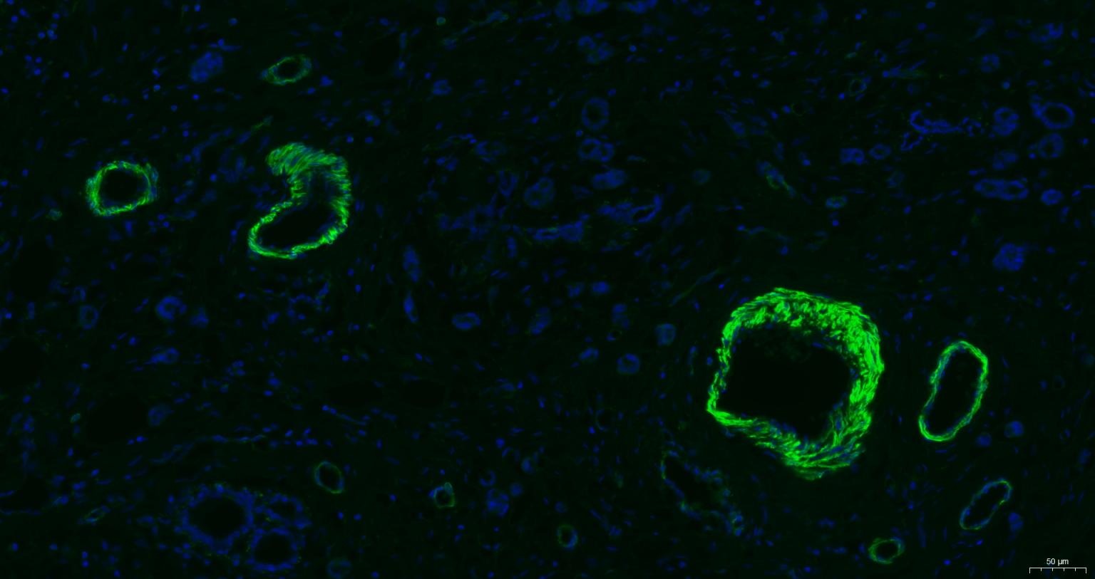 Anti-ACTA2 Antibody (7C949)