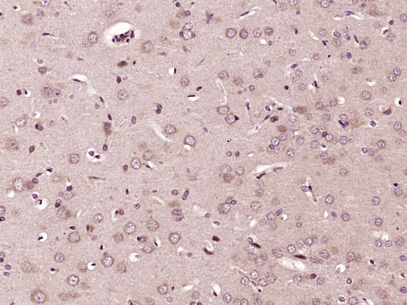 Anti-ABCG1 Polyclonal Antibody