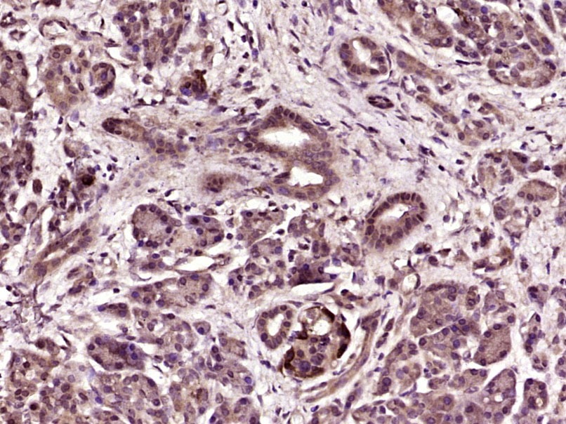 Anti-ABCG1 Polyclonal Antibody