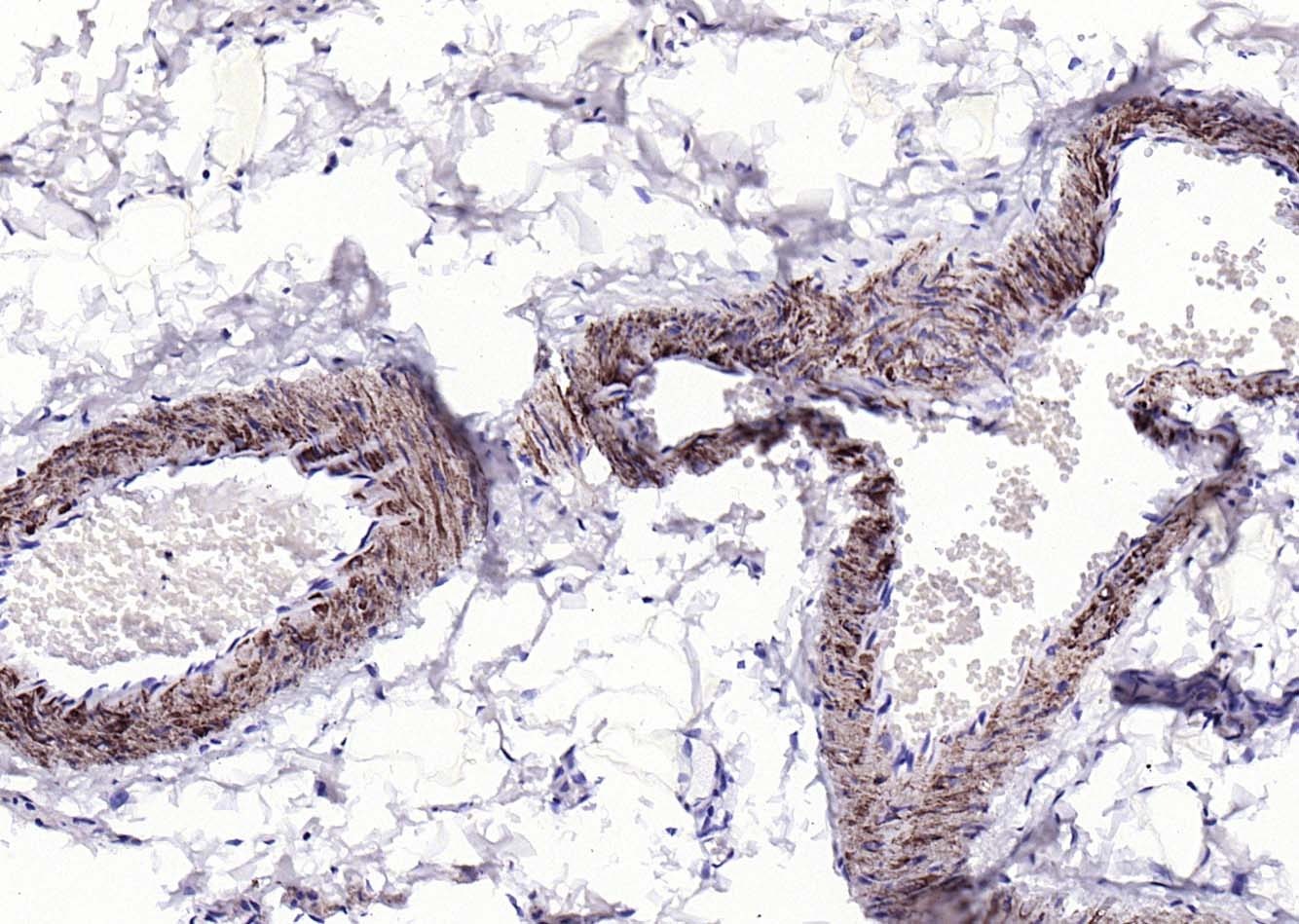 Anti-ACTA2 Polyclonal Antibody
