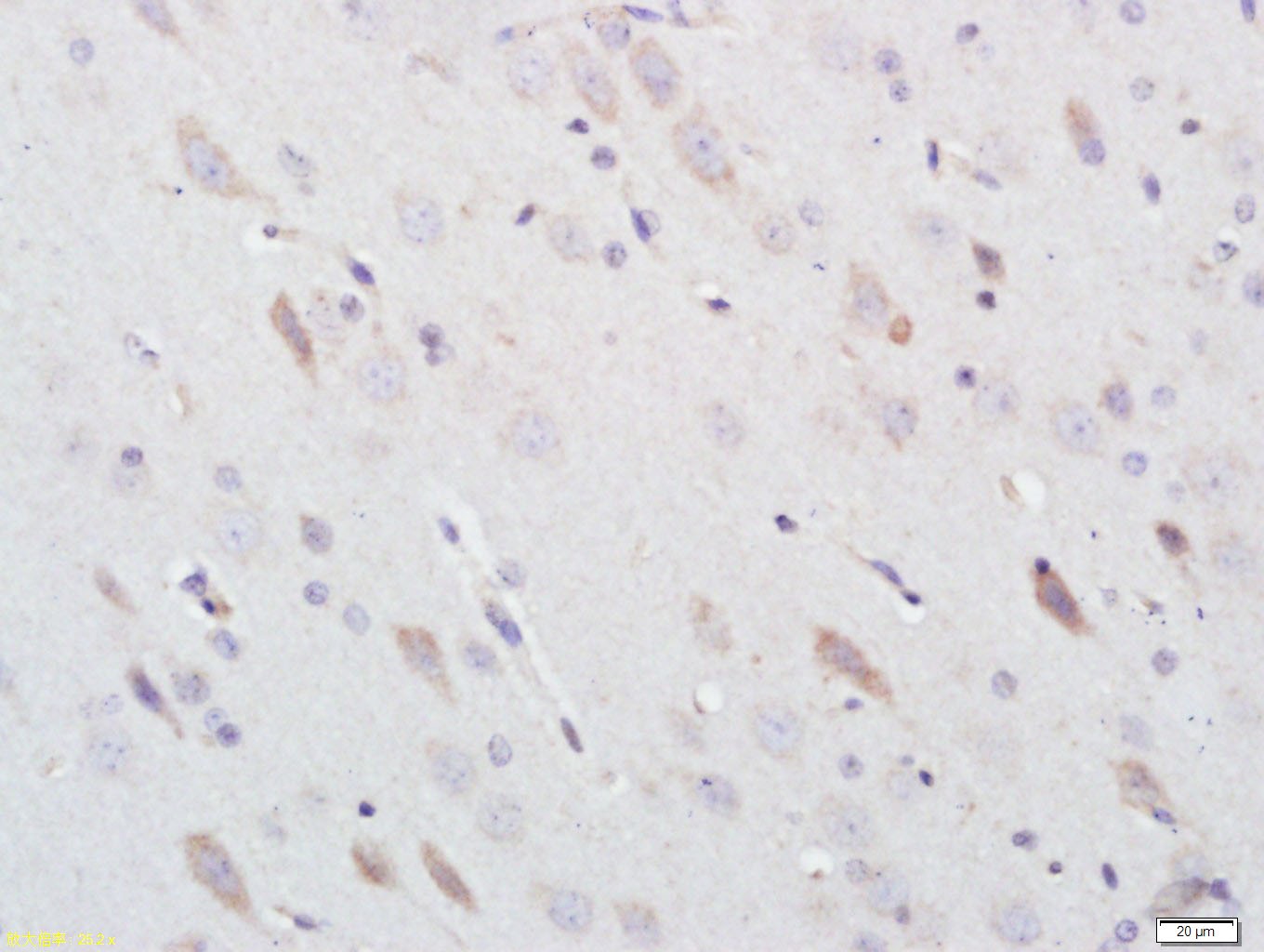 Anti-3-Nitro-L-tyrosine Polyclonal Antibody