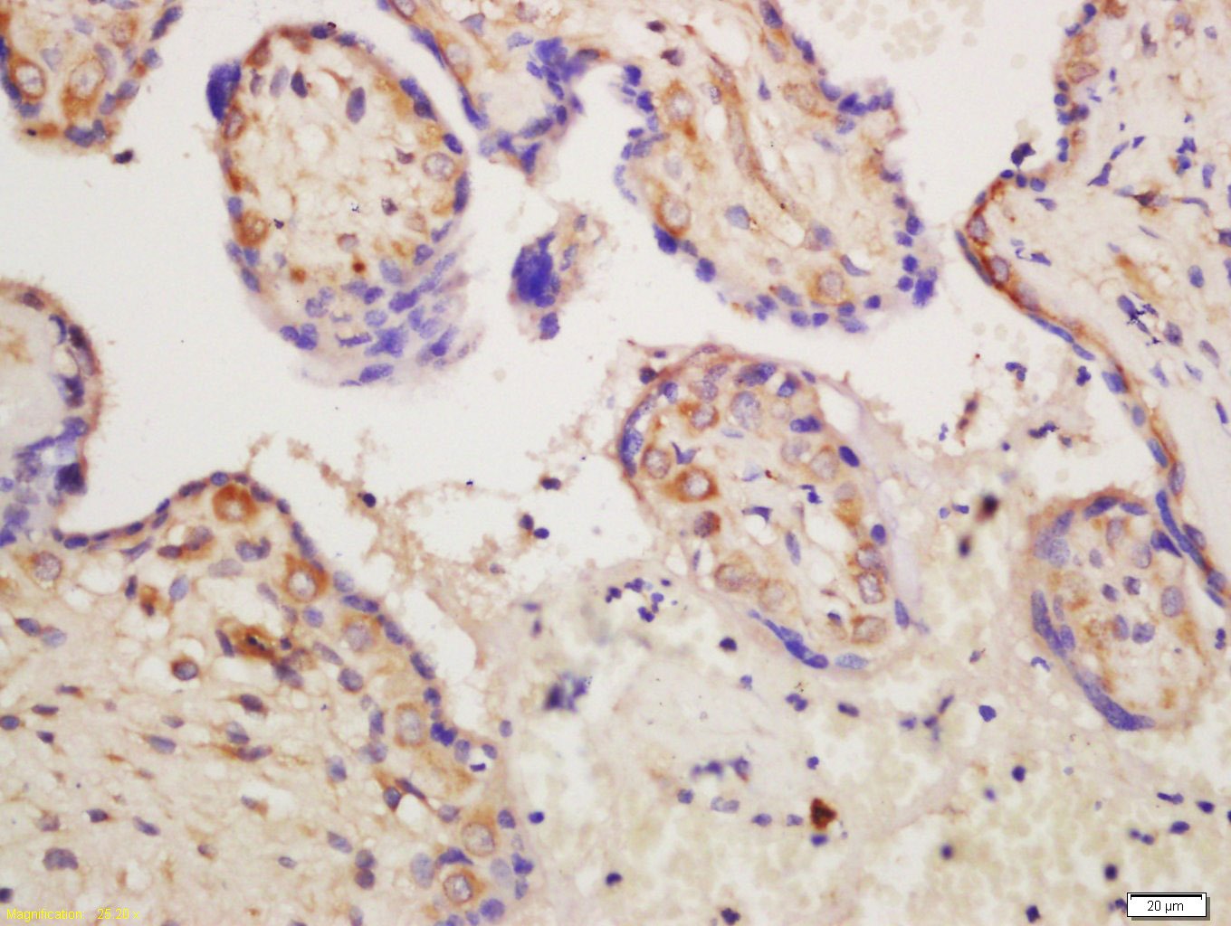 Anti-ABI3BP Polyclonal Antibody