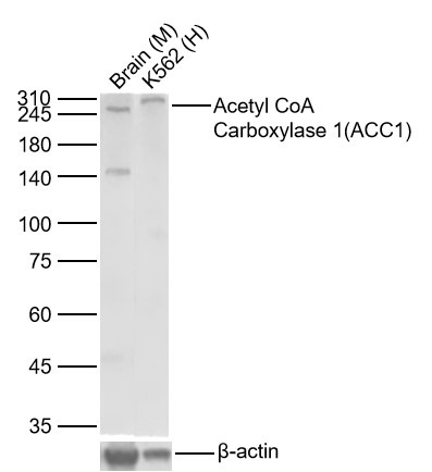 Anti-ACACA Antibody (3I598)