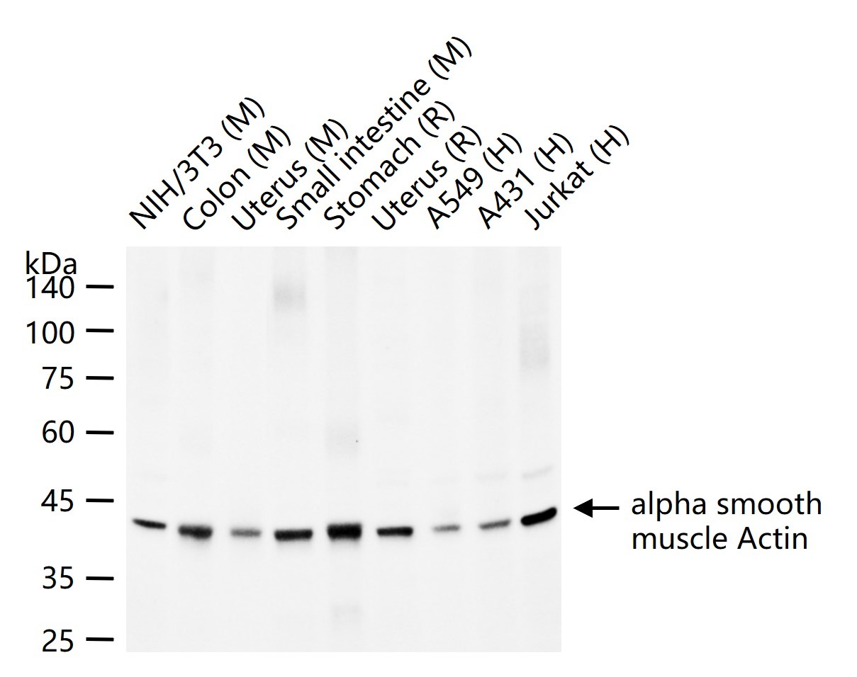 Anti-ACTA2 Polyclonal Antibody