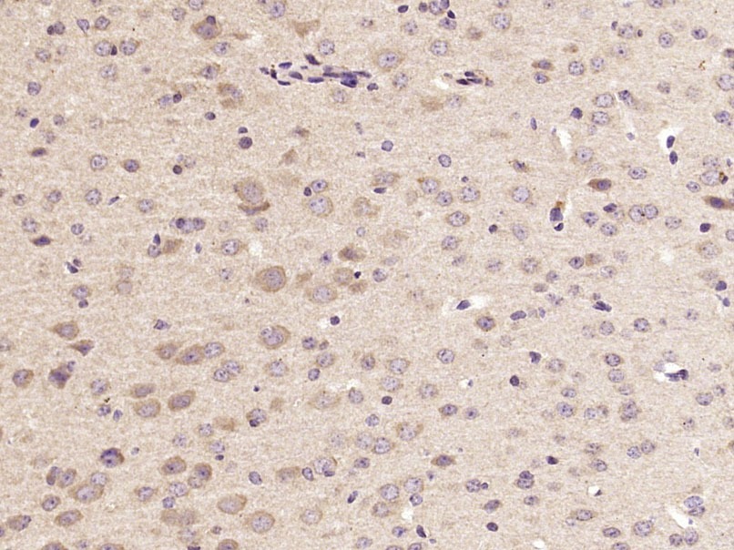 Anti-Acetylcholinesterase Polyclonal Antibody