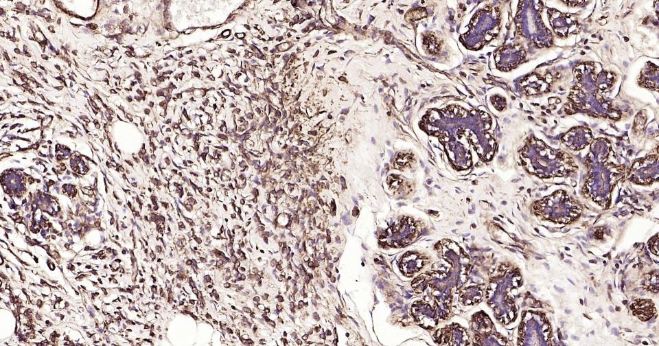 Anti-ACTA2 Antibody (3P485)