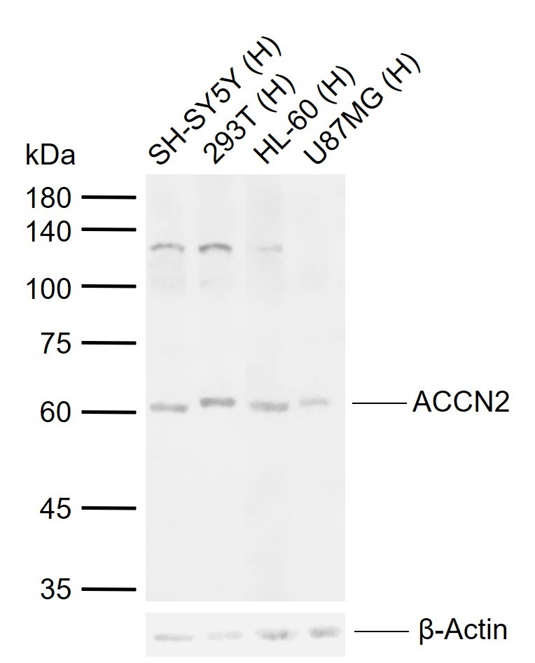 Anti-ACCN2 Polyclonal Antibody