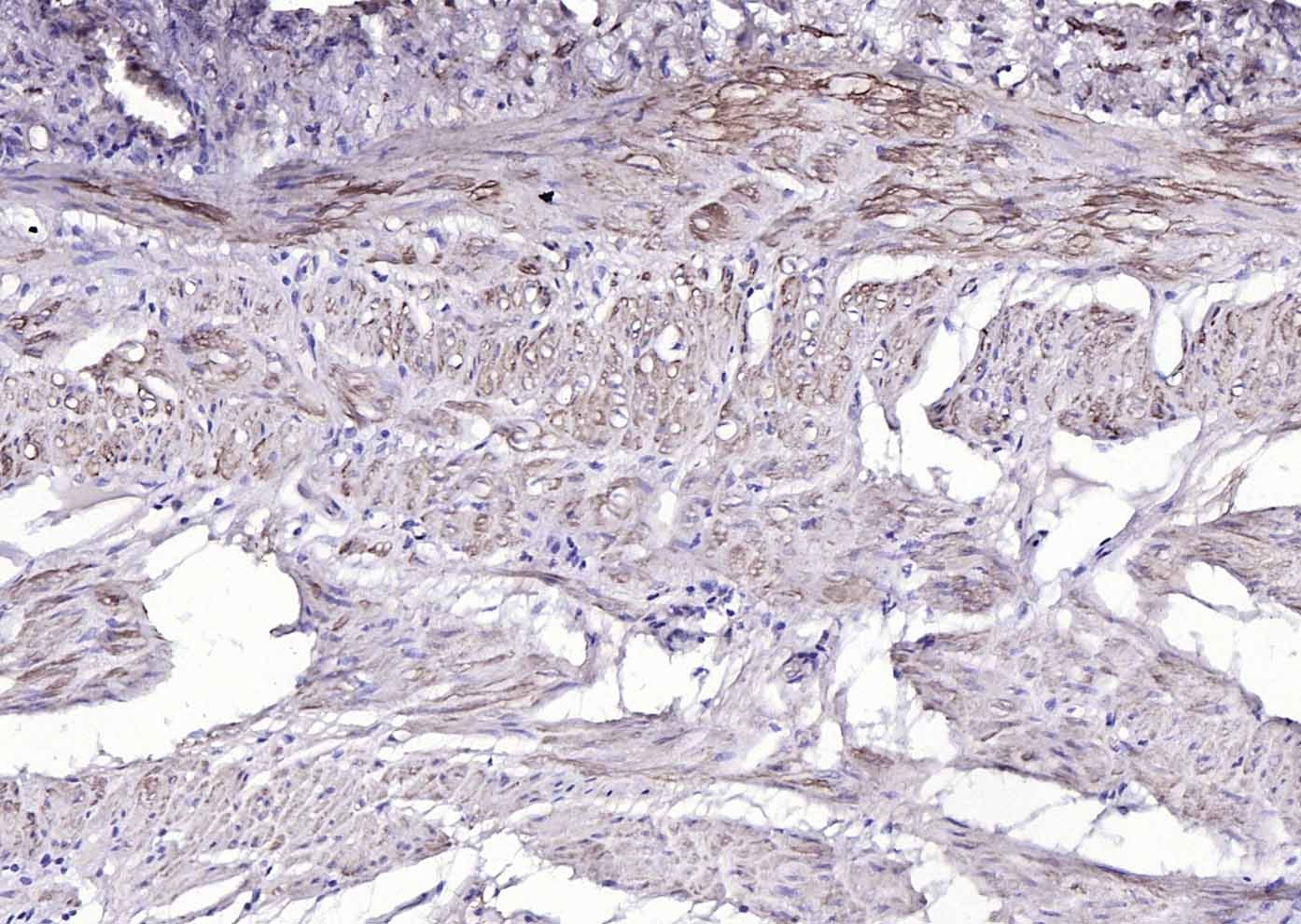 Anti-ACTA2 Polyclonal Antibody