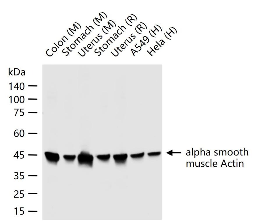 Anti-ACTA2 Antibody (3P485)