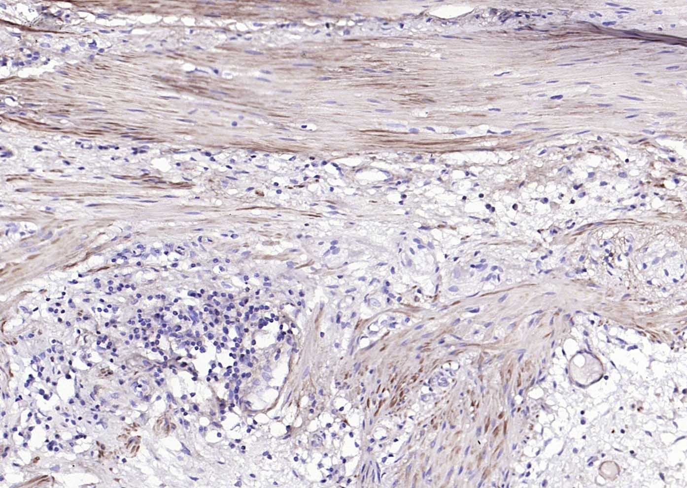 Anti-ACTA2 Polyclonal Antibody