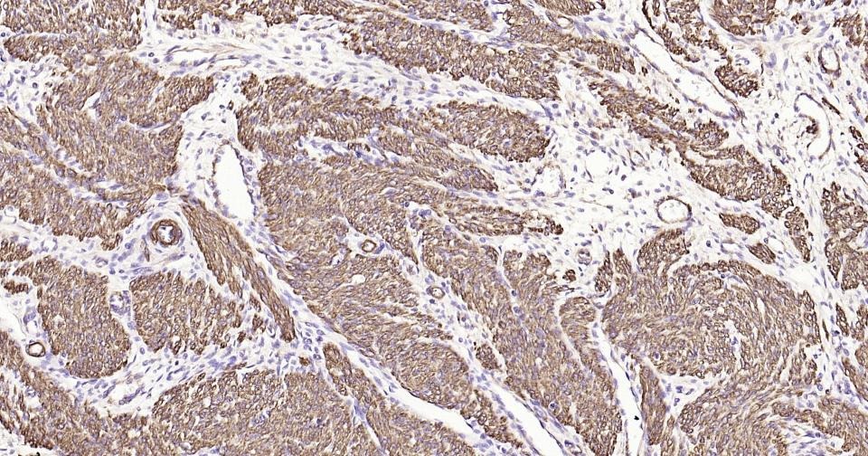 Anti-ACTA2 Antibody (3P485)
