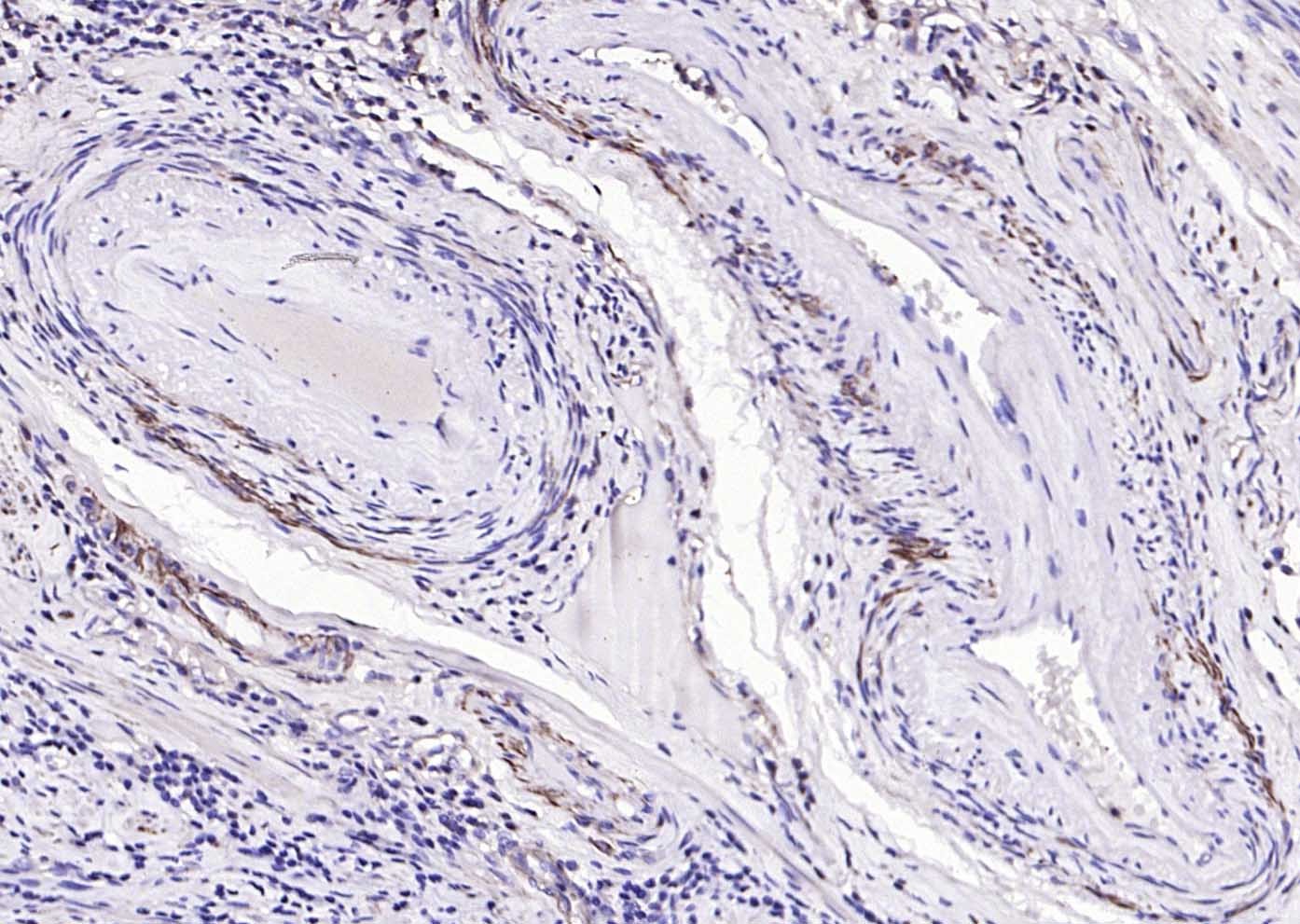 Anti-ACTA2 Polyclonal Antibody