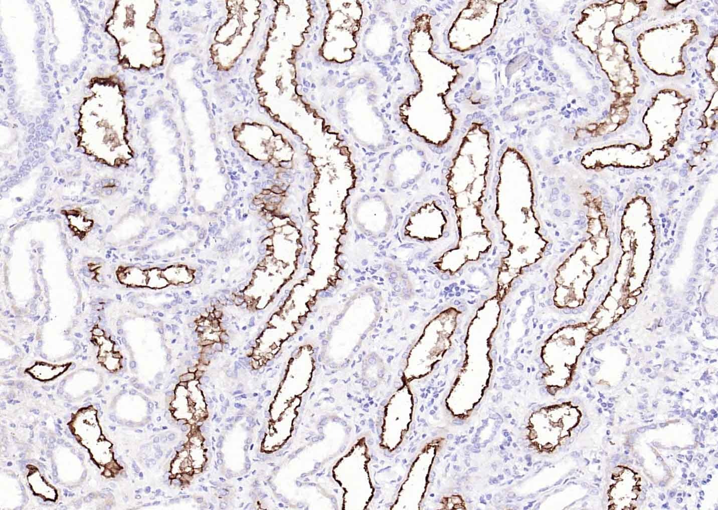 Anti-ACE2 Polyclonal Antibody