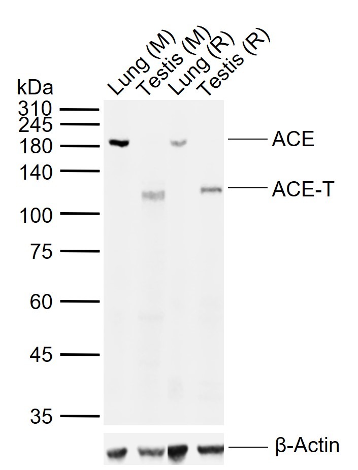 Anti-ACE Polyclonal Antibody