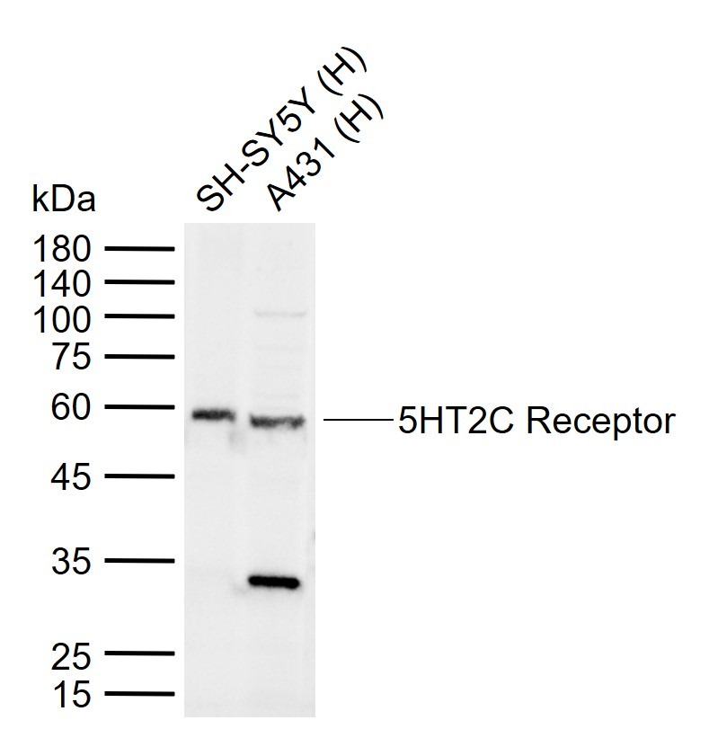 Anti-5HT2C Receptor Polyclonal Antibody