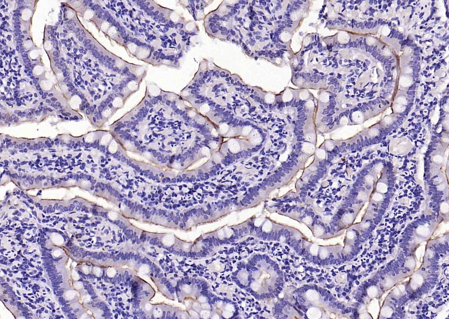 Anti-ACE2 Polyclonal Antibody