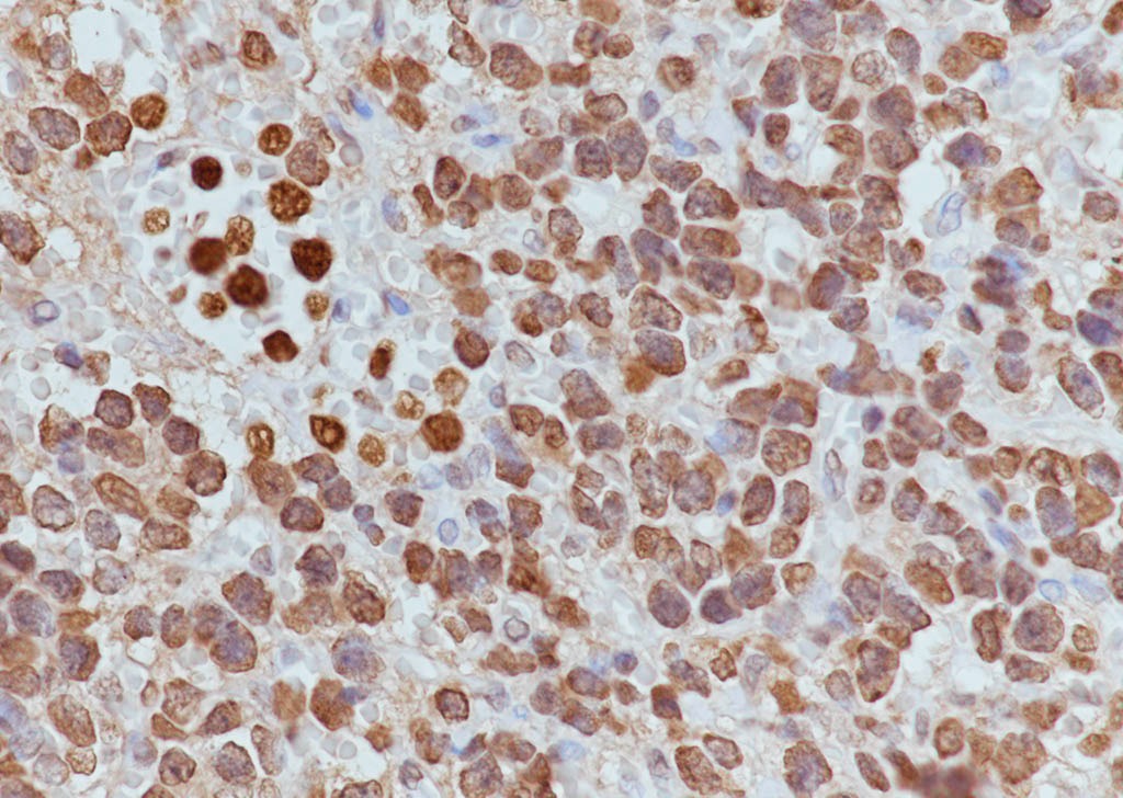 Anti-Acetyl-Histone H4 (Lys12) Antibody (8Z904)
