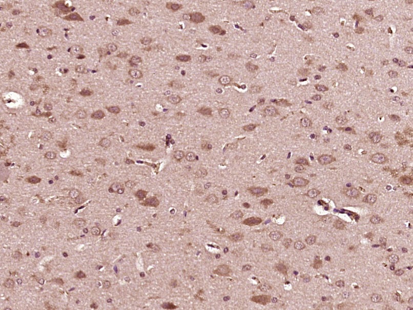 Anti-Acid sphingomyelinase/SMPD1 Polyclonal Antibody