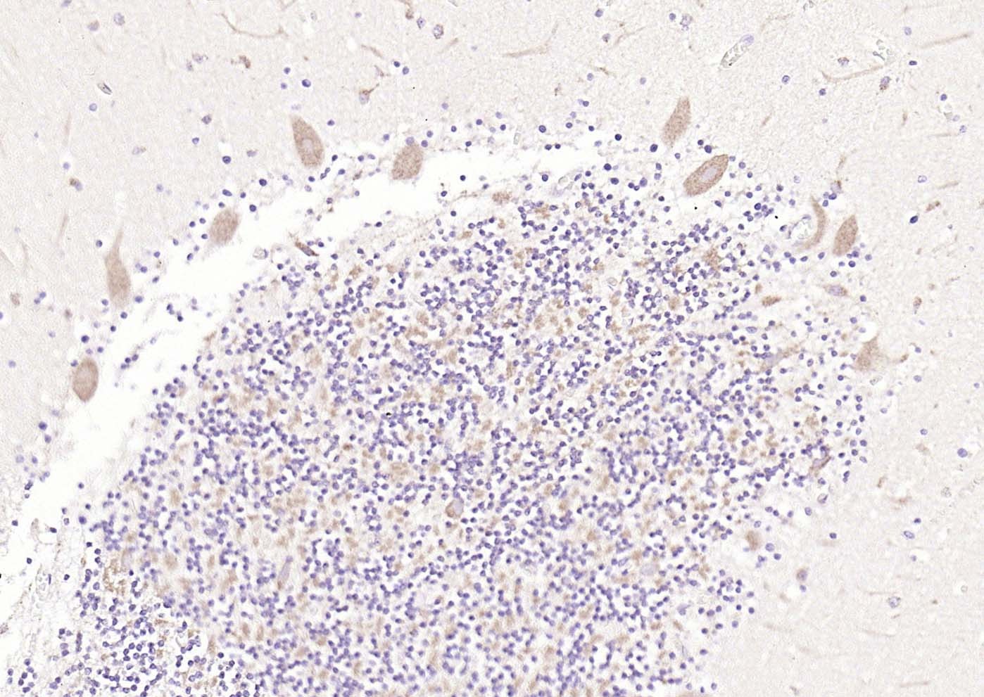 Anti-5HT7 Receptor Polyclonal Antibody