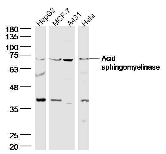Anti-Acid sphingomyelinase/SMPD1 Polyclonal Antibody