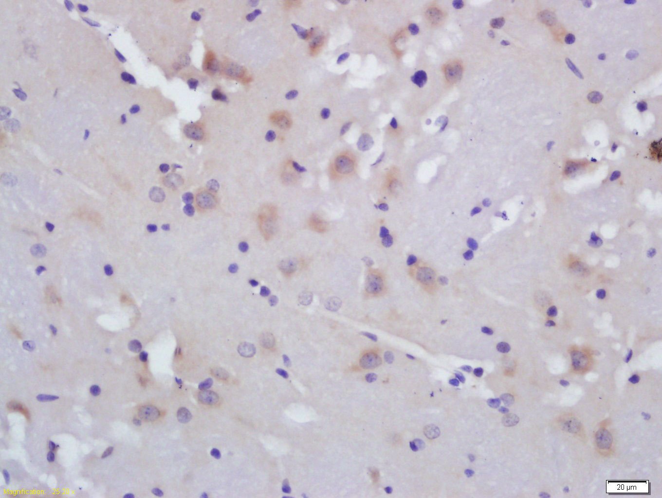 Anti-ALOX5AP Polyclonal Antibody