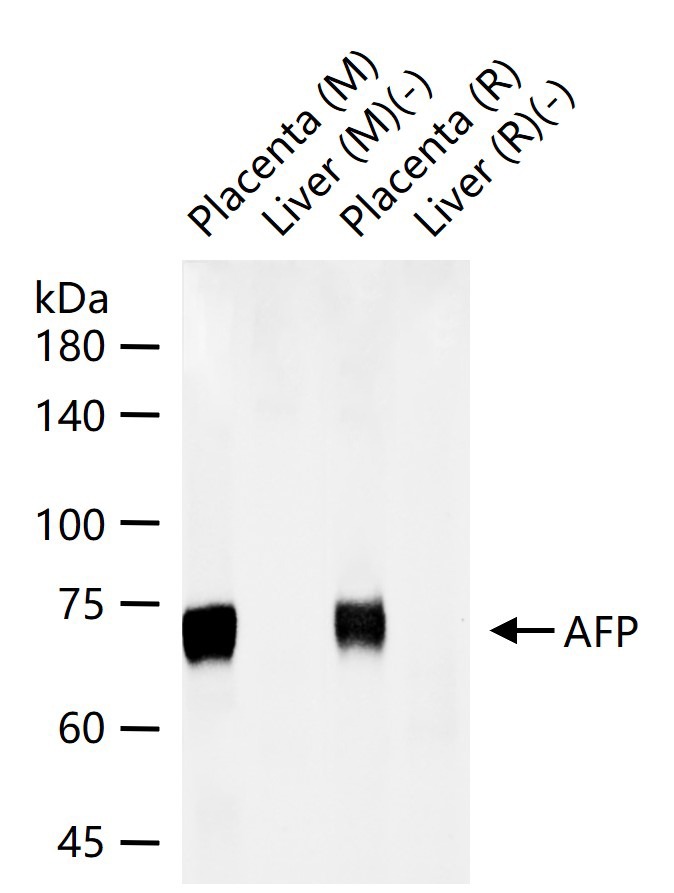Anti-Alpha-fetoprotein Antibody (5G216)