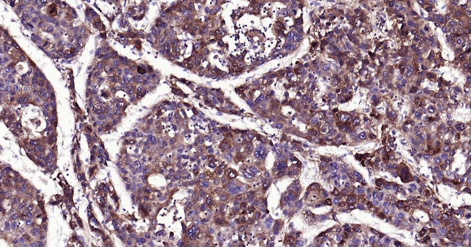 Anti-Alpha-fetoprotein Antibody (5G216)