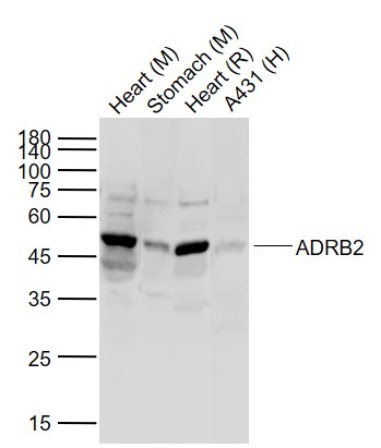 Anti-ADRB2 Polyclonal Antibody 2