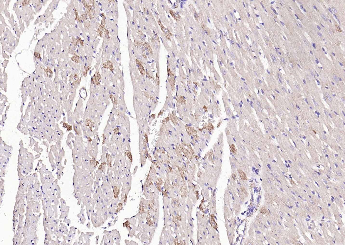 Anti-Angiopoietin-1 Polyclonal Antibody