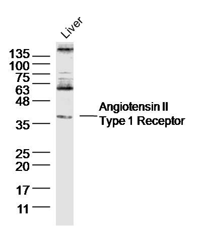 Anti-AGTR1 Polyclonal Antibody
