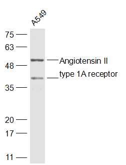 Anti-AGTR1 Polyclonal Antibody 2