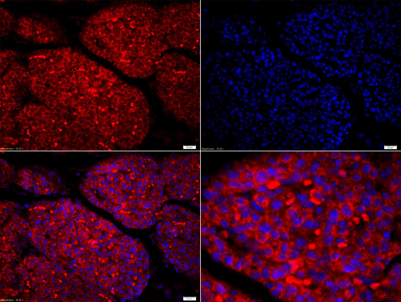 Anti-Amphiregulin Polyclonal Antibody