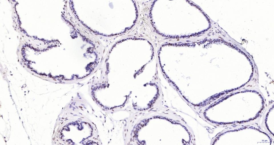 Anti-Androgen receptor Polyclonal Antibody