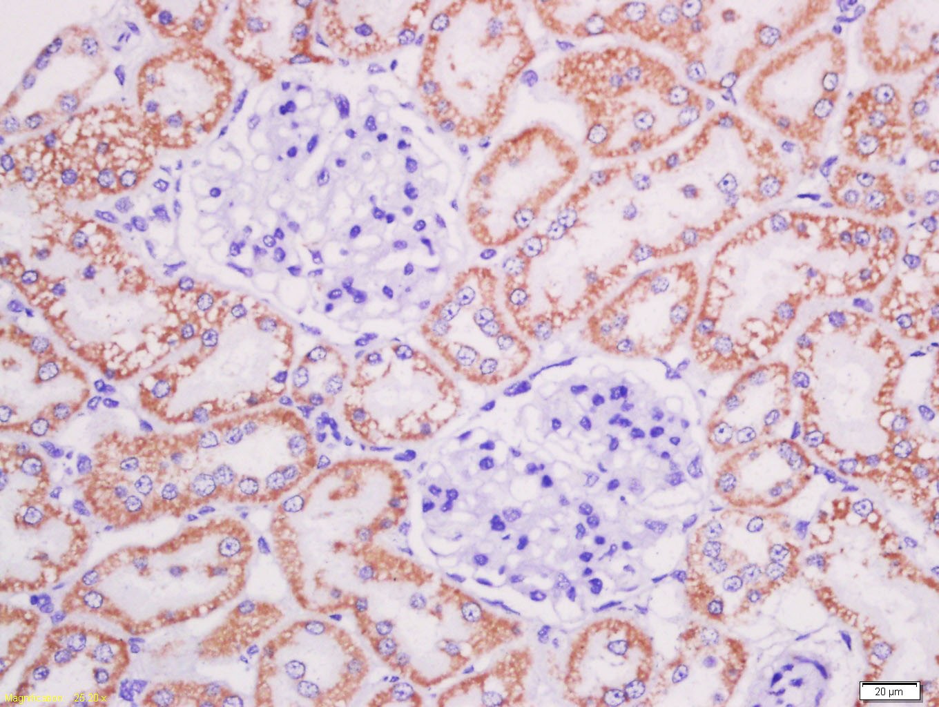 Anti-AGEs Polyclonal Antibody