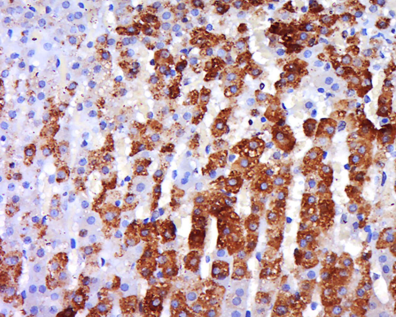 Anti-ADRB3 Polyclonal Antibody
